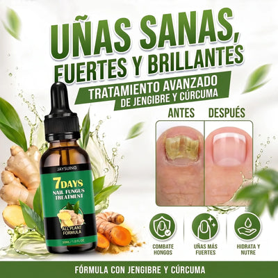 7 Days: Dale Vida A tus Uñas, Elimina Hongos, Uñas Oscuras y Haslas Crecer!!!💅🏻