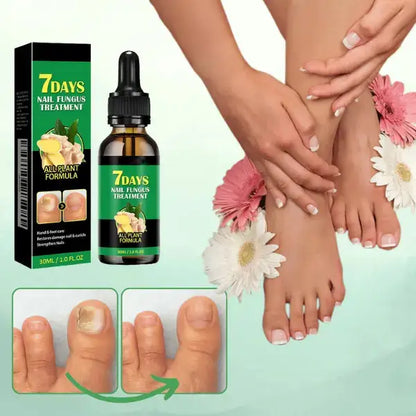 7 Days: Dale Vida A tus Uñas, Elimina Hongos, Uñas Oscuras y Haslas Crecer!!!💅🏻