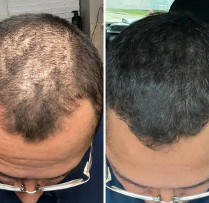 Hair Growth ®: Dale A Tu Cabello El Cuidado Que Merece