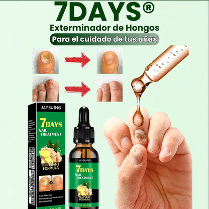 7 Days: Dale Vida A tus Uñas, Elimina Hongos, Uñas Oscuras y Haslas Crecer!!!💅🏻
