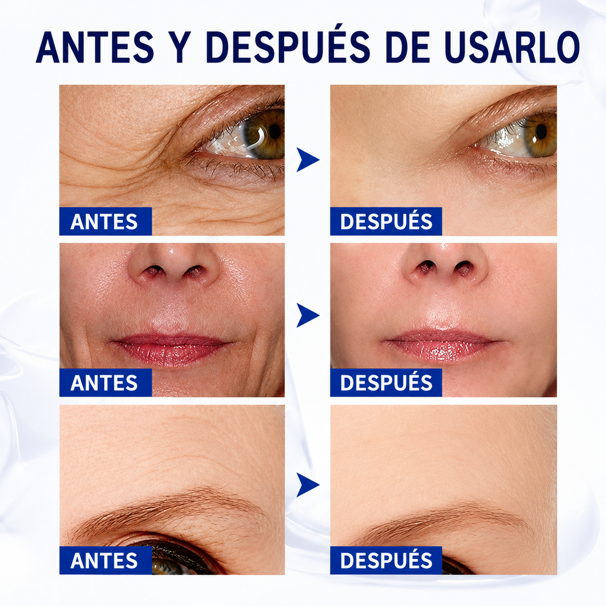 BOTOX STOCK SOLUTION™: 💙 Dale a tu piel el cuidado que se merece todos los días.