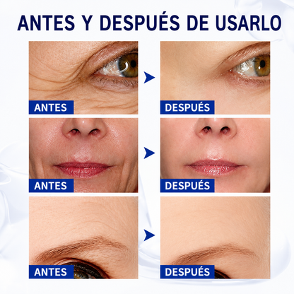 BOTOX STOCK SOLUTION™: 💙 Dale a tu piel el cuidado que se merece todos los días.