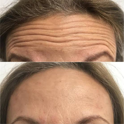 BOTOX STOCK SOLUTION™: 💙 Dale a tu piel el cuidado que se merece todos los días.